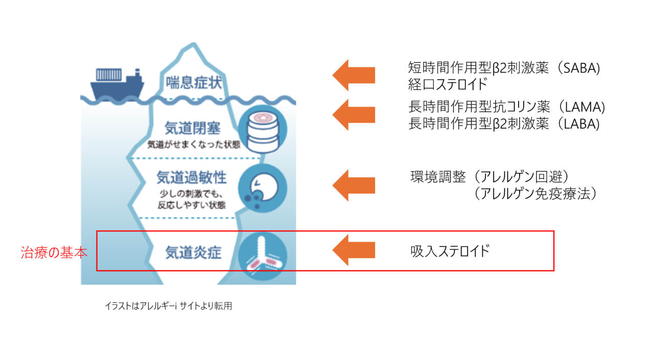 気管支喘息の治療のイラスト